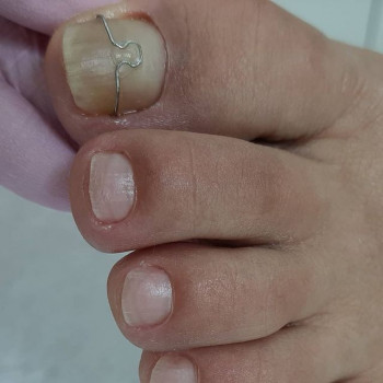 Анна Ткачук, Novosibirsk Фото - 5