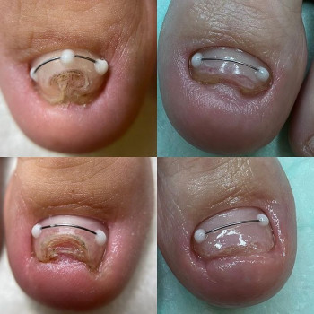 Ирина Захарова, Nizhny Novgorod Фото - 6