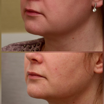 Артур Казгериевич Дзотцоев, Moscow Фото - 5