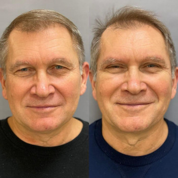 Любовь Николаевна Акрум, Moscow Фото - 5