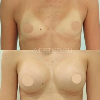 Владимир Сергеевич Авдеенков, Moscow Фото - 5