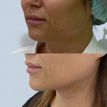 Кира Анатольевна Кириллова, Moscow Фото - 5