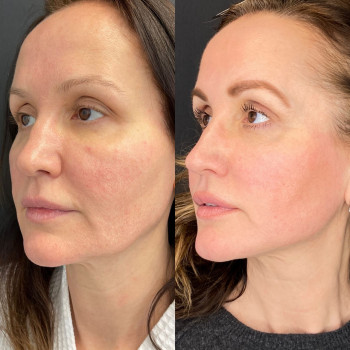 Арам Артурович Григорян, Moscow Фото - 5