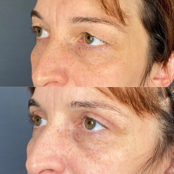 Хуршид Хамзаевич Бозоров, Moscow Фото - 5