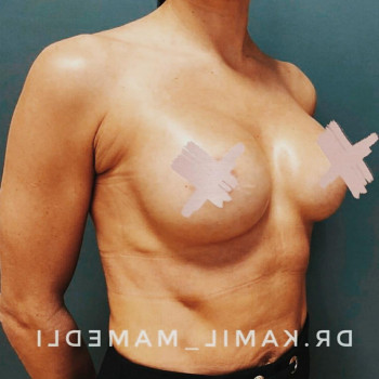 Камил Гахраман оглы Мамедли, Moscow Фото - 5