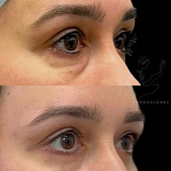 Никита Сергеевич Покаленьев, Moscow Фото - 5