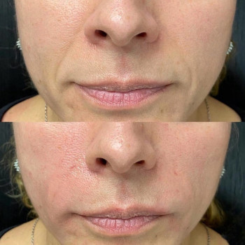 Айтадж Ганбарова, Yekaterinburg Фото - 5