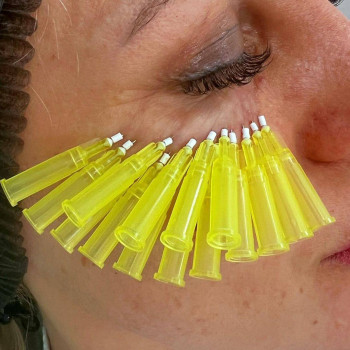 Алена Илмаз, Novosibirsk Фото - 5