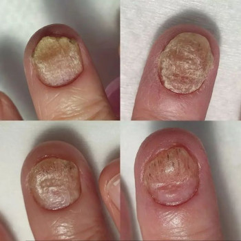 Inki, Ufa Фото - 6