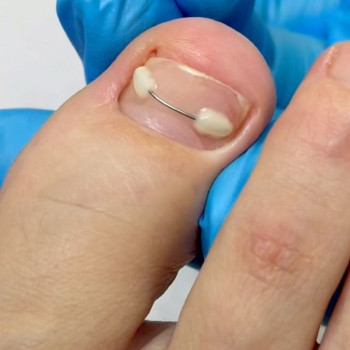 Первый подологический центр, Krasnoyarsk Фото - 5