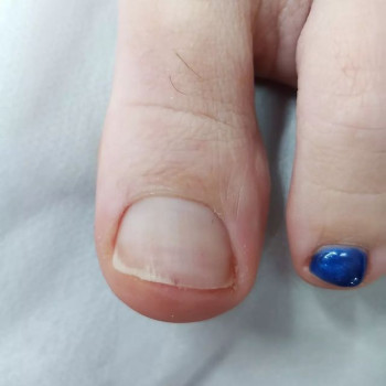 Покрытие ногтей гель-лаком / ноги