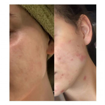 Мария Госк, Гданьск Фото - 5