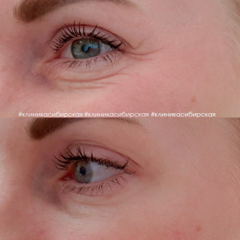 Сибирская клиника эстетической медицины, Novosibirsk Фото - 5