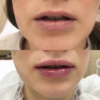 Новая линия, Novosibirsk Фото - 5