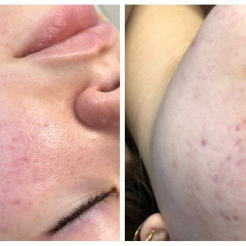 Мартина Чеховска, Гданьск Фото - 5