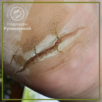 Надежда Румянцева, Moscow Фото - 5