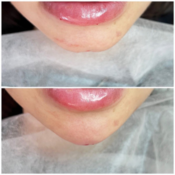 Валерия Гольд, Yekaterinburg Фото - 5