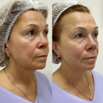 Анна Пегарькова, Yekaterinburg Фото - 5