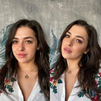 Skin revolution, Gdańsk Фото - 5