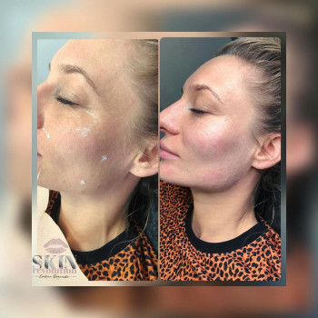 Skin revolution, Gdańsk Фото - 6