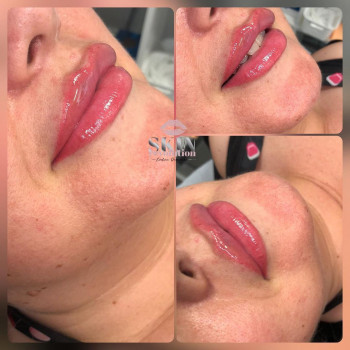 Skin revolution, Gdańsk Фото - 7