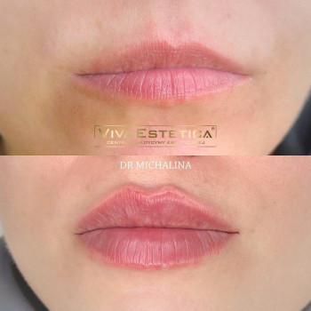 Viva estetica_, Гданьск Фото - 5