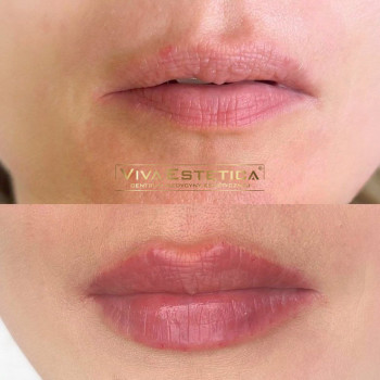 Viva estetica_, Гданьск Фото - 6