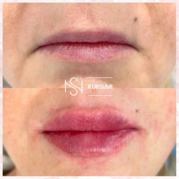 Ума Кадиева, Yekaterinburg Фото - 5