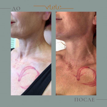 VTelo, Yekaterinburg Фото - 5