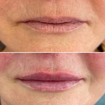 Шанталь, Yekaterinburg Фото - 5