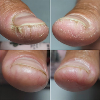 Елена Сычева, Mytischi Фото - 5