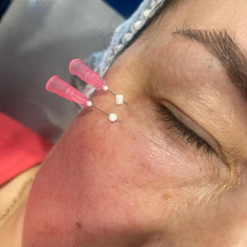 Daria Drazkiewicz, Krakow Фото - 5