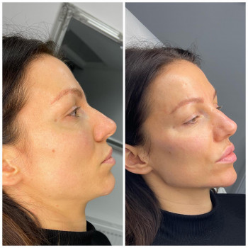 Dermina, Kraków Фото - 5