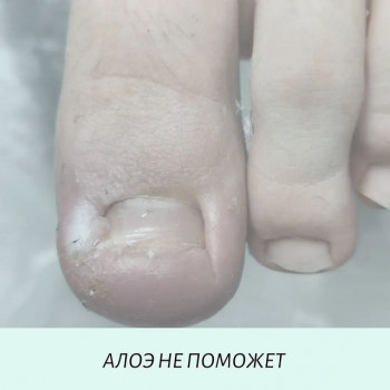 Олеся Дурнева, Perm Фото - 5