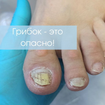 Ваш Подолог, Электросталь Фото - 5