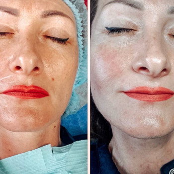 Oksana Panova, Poznań Фото - 5