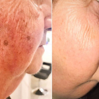 Czar piekna, Poznan Фото - 6