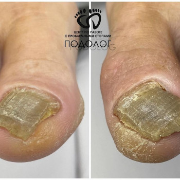 Подолог, Набережные Челны Фото - 5