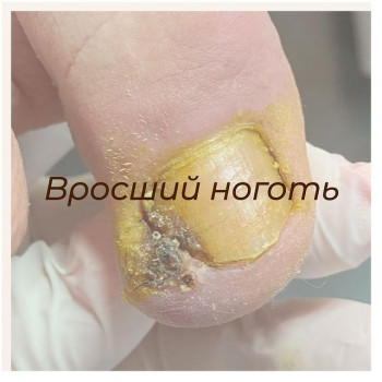 Наиля Шигапова, Naberezhnye Chelny Фото - 5