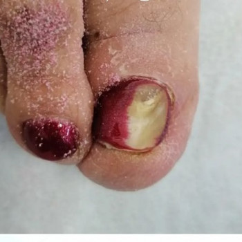 Ирина Буракова, Balashikha Фото - 5