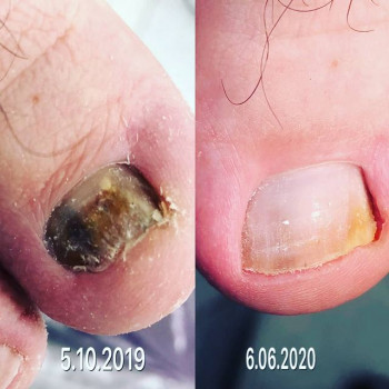 Татьяна Самохина, Balashikha Фото - 5