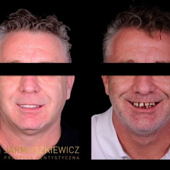 Praktyka dentystyczna jarmuszkiewicz, Poznan Фото - 6