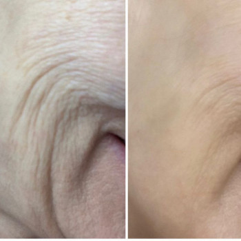 Ika Pankovska, Poznań Фото - 6