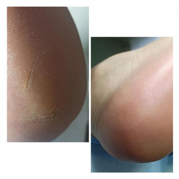 Елена Щербакова, Stavropol Фото - 5