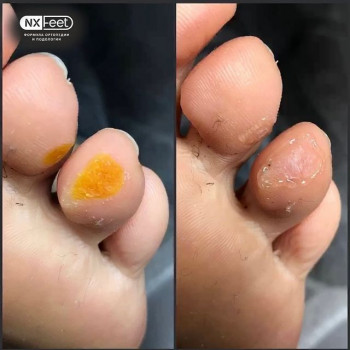 Надежда Хакимова, Kolomna Фото - 5