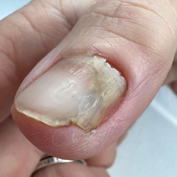 ‌Алтайский Центр Педикюра, Barnaul Фото - 5