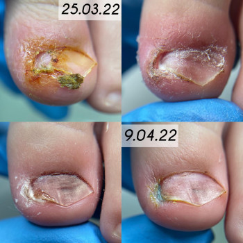 Цисана , Ulyanovsk Фото - 5