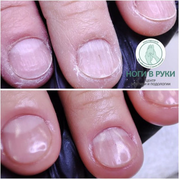 Ноги в руки, Ulyanovsk Фото - 5