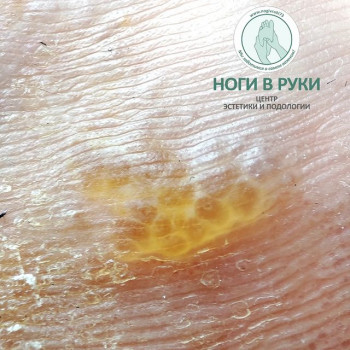 Ноги в руки, Ulyanovsk Фото - 6