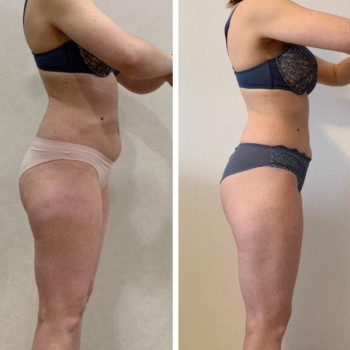 Bodika laser, Yekaterinburg Фото - 5